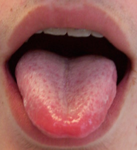 Tongue 22