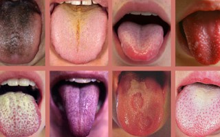 Zeg eens AAA… wat jouw tong allemaal te vertellen heeft